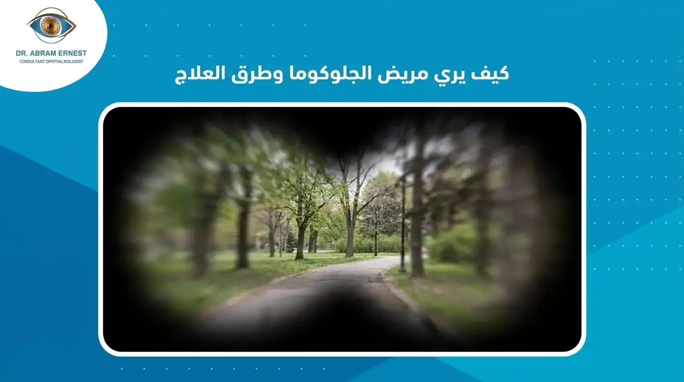 كيف يري مريض الجلوكوما وطرق العلاج
