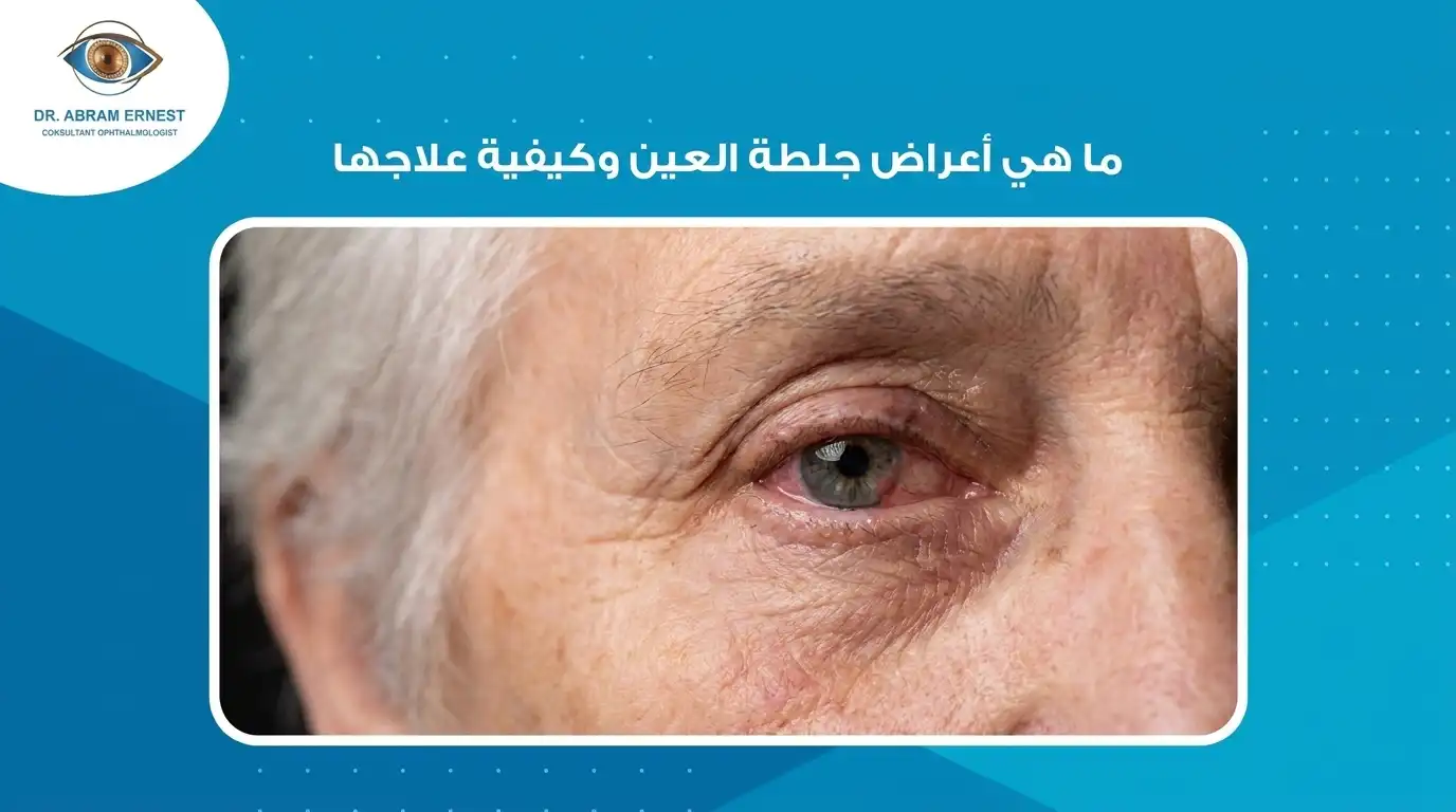 ما هي أعراض جلطة العين وكيفية علاجها