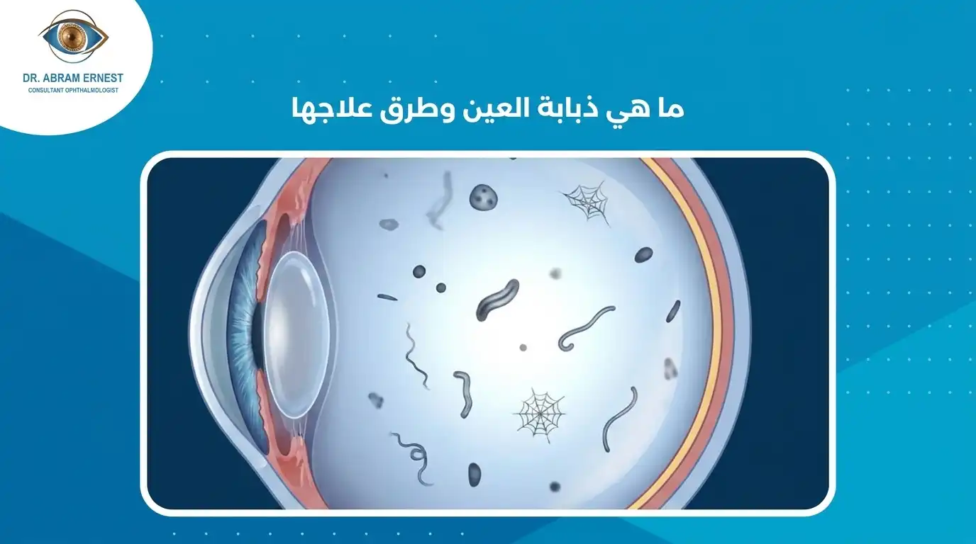 ما هي ذبابة العين وطرق علاجها