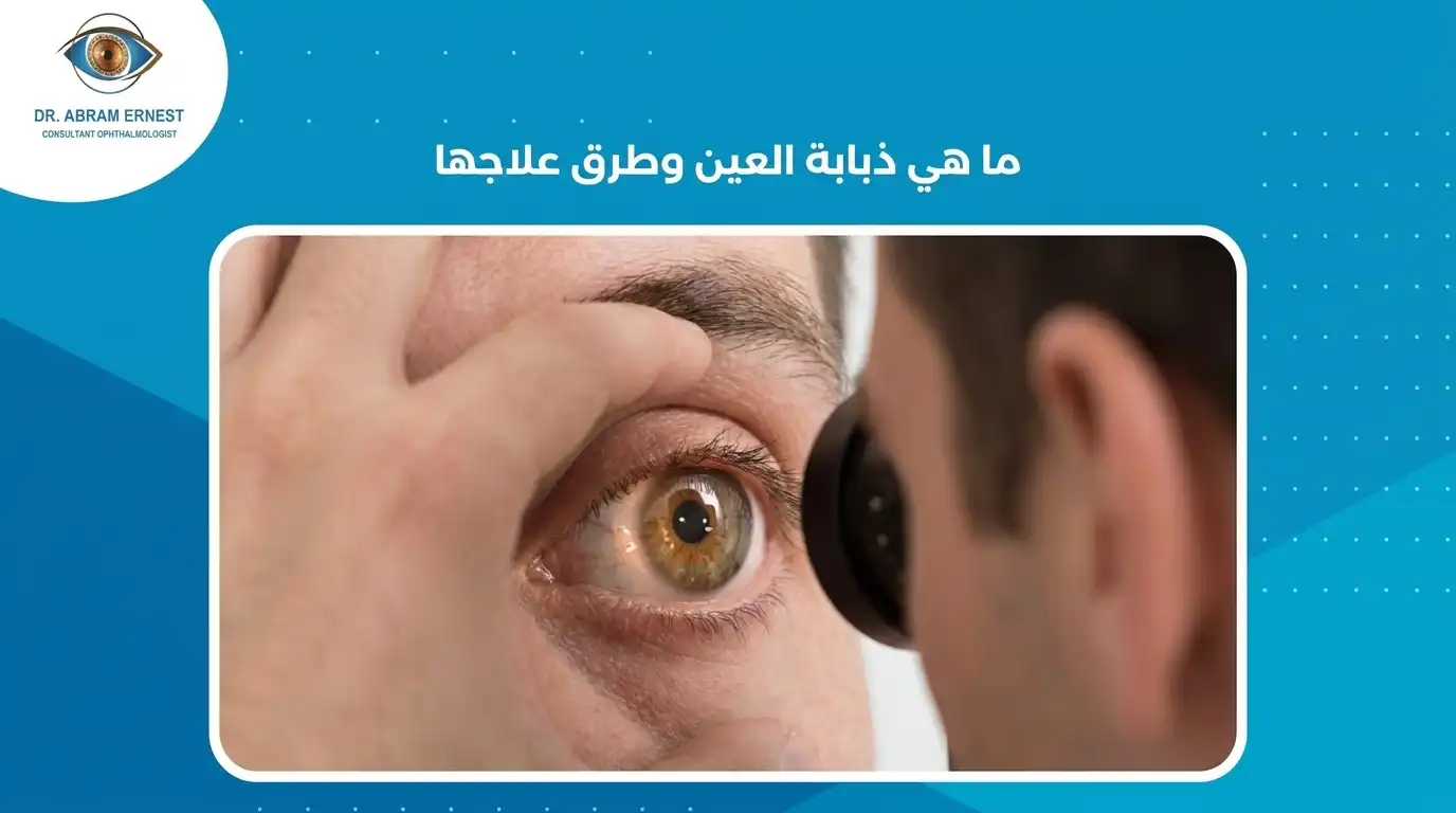 ما هي ذبابة العين وطرق علاجها