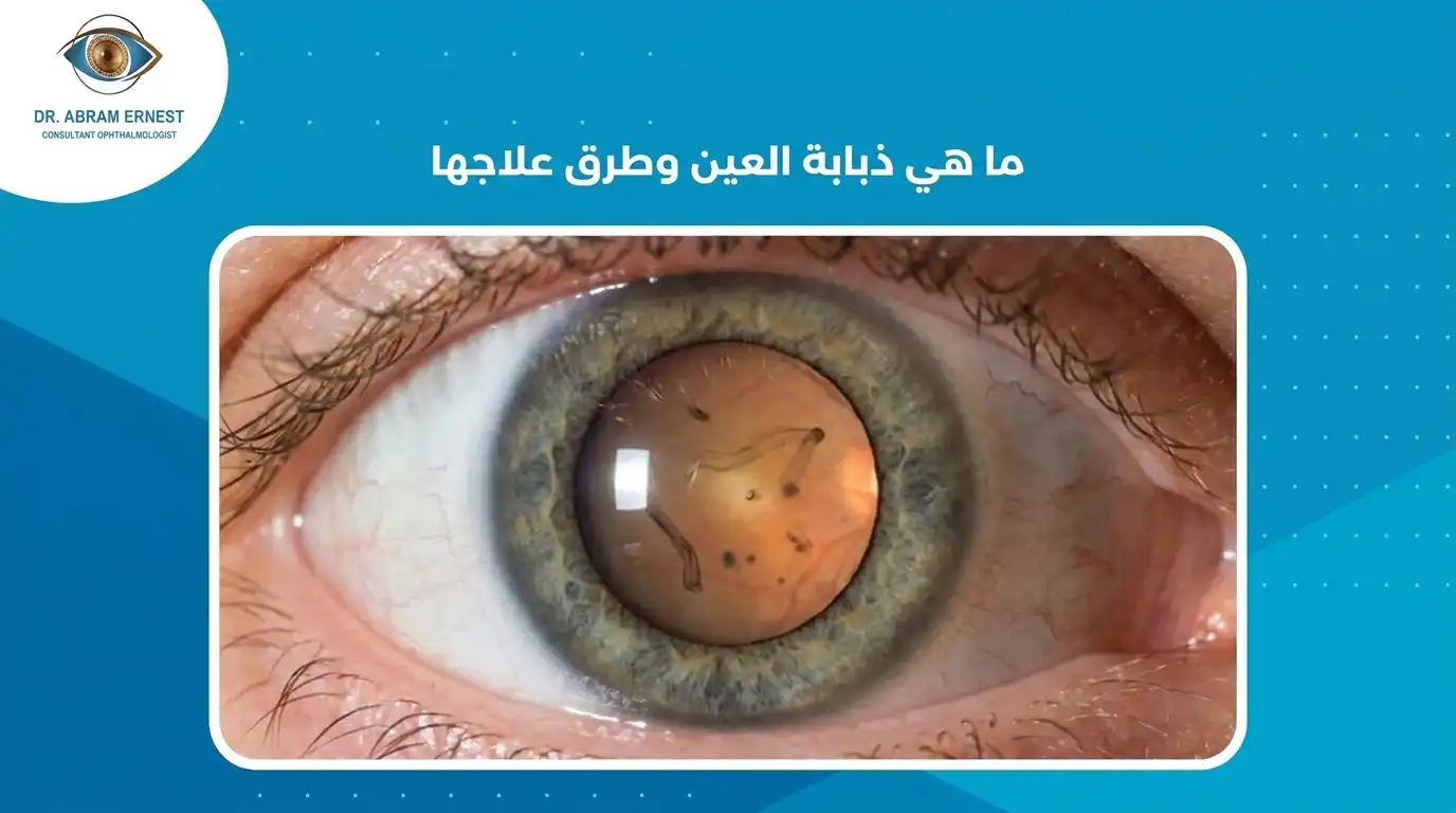 ما هي ذبابة العين وطرق علاجها