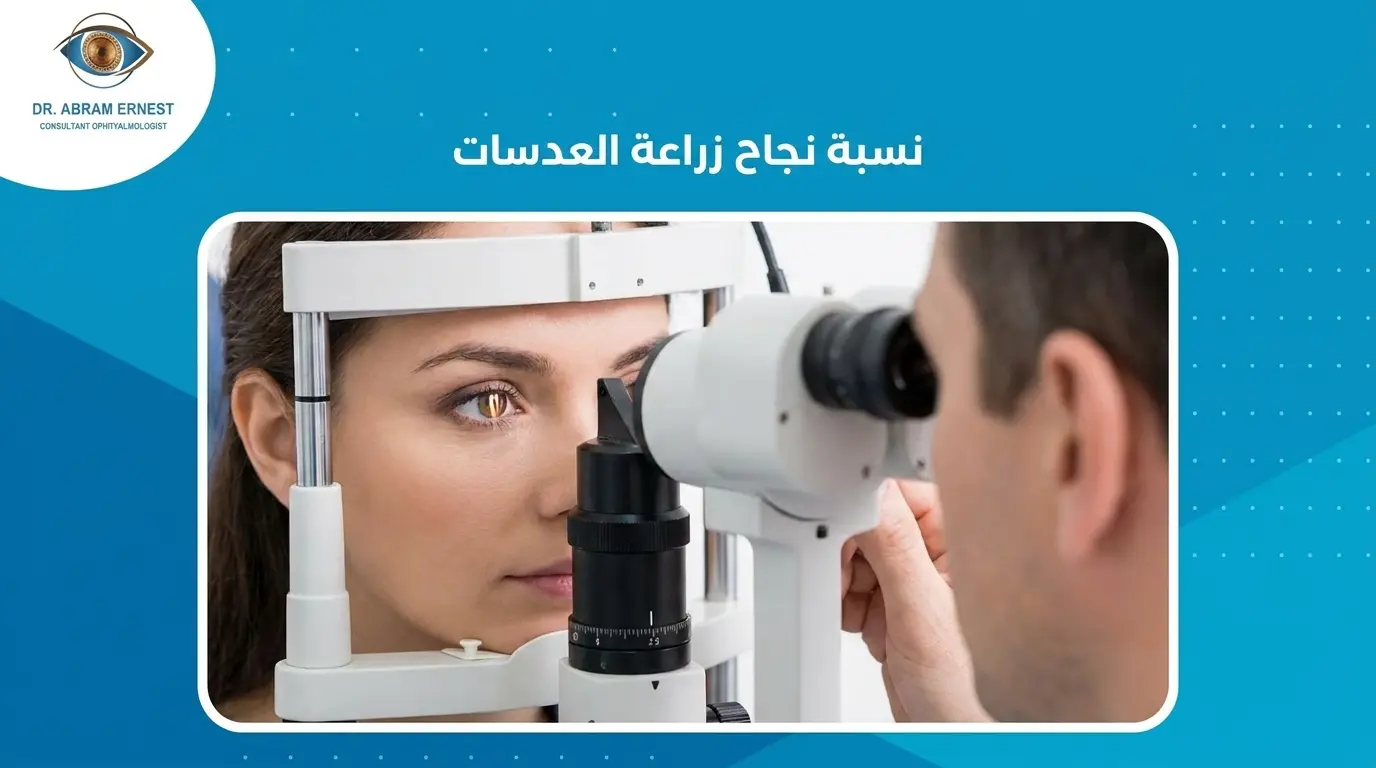 نسبة نجاح زراعة العدسات