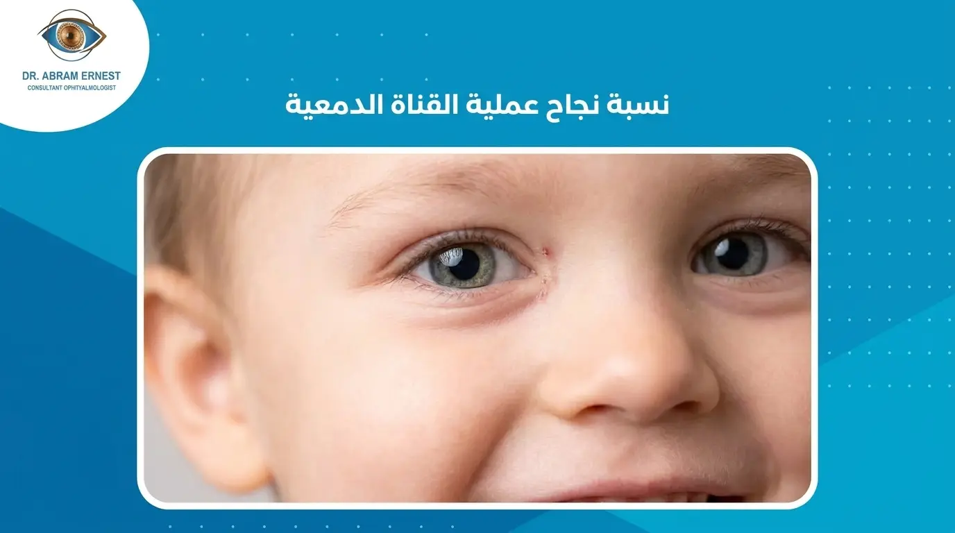 نسبة نجاح عملية تسليك القناة الدمعية
